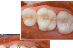 Dr Burak Aksu Ortodonti Uzmanı